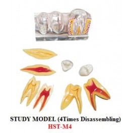 https://www.dentalmart.in/1379-thickbox_default/study-model-4-times-disassembling-.jpg